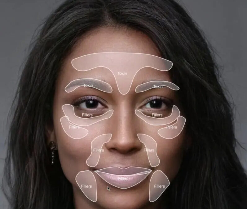 Where can I get some?